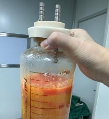 象山水动力吸脂手术要做多久？